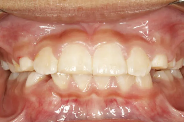 Before image