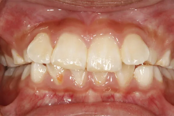 After image