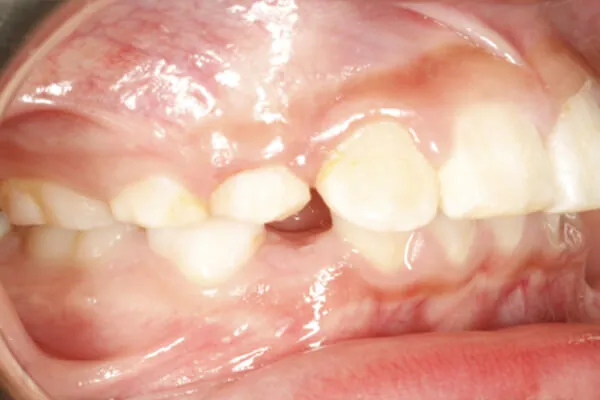 Before image