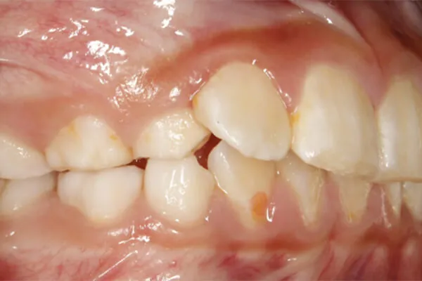 After image