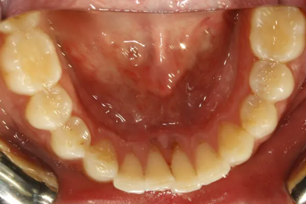 After image